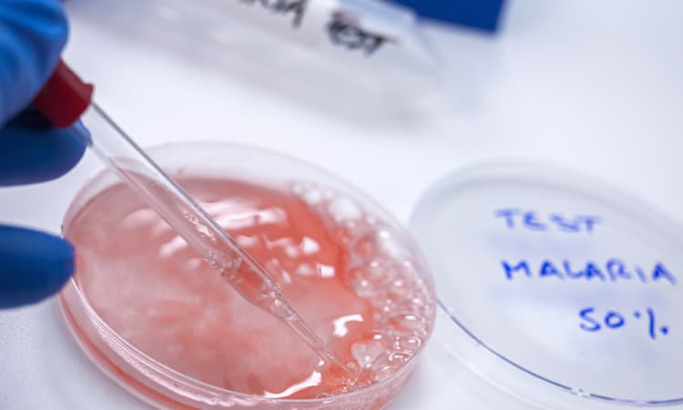 Germany’s BioNTech aims to develop world’s first mRNA malaria vaccine 