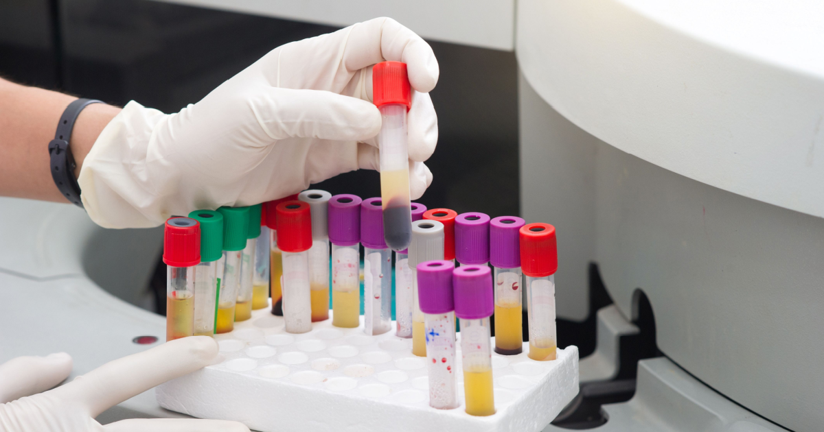 In which German cities are STDs most common?