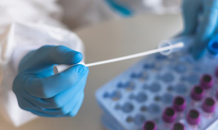 First monkeypox cases confirmed in Germany, health ministry expects more