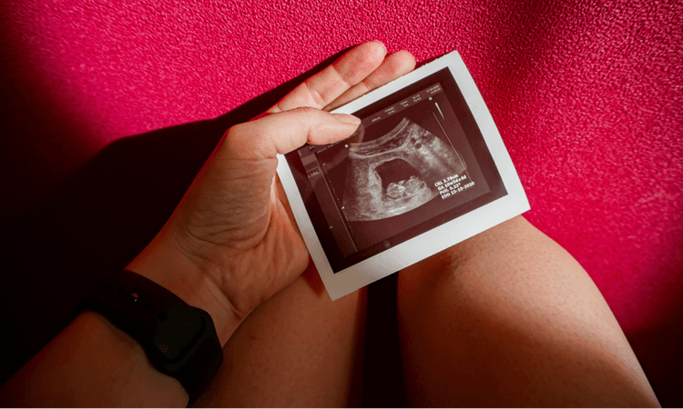 German Bundestag expands employee protections following miscarriage