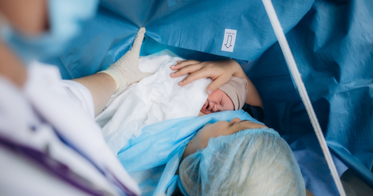 A guide to planning a C-section in Germany